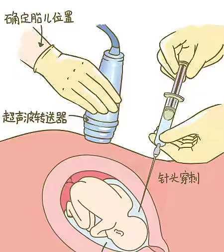 温州供卵试管卵源质量如何判断？评估要点分享